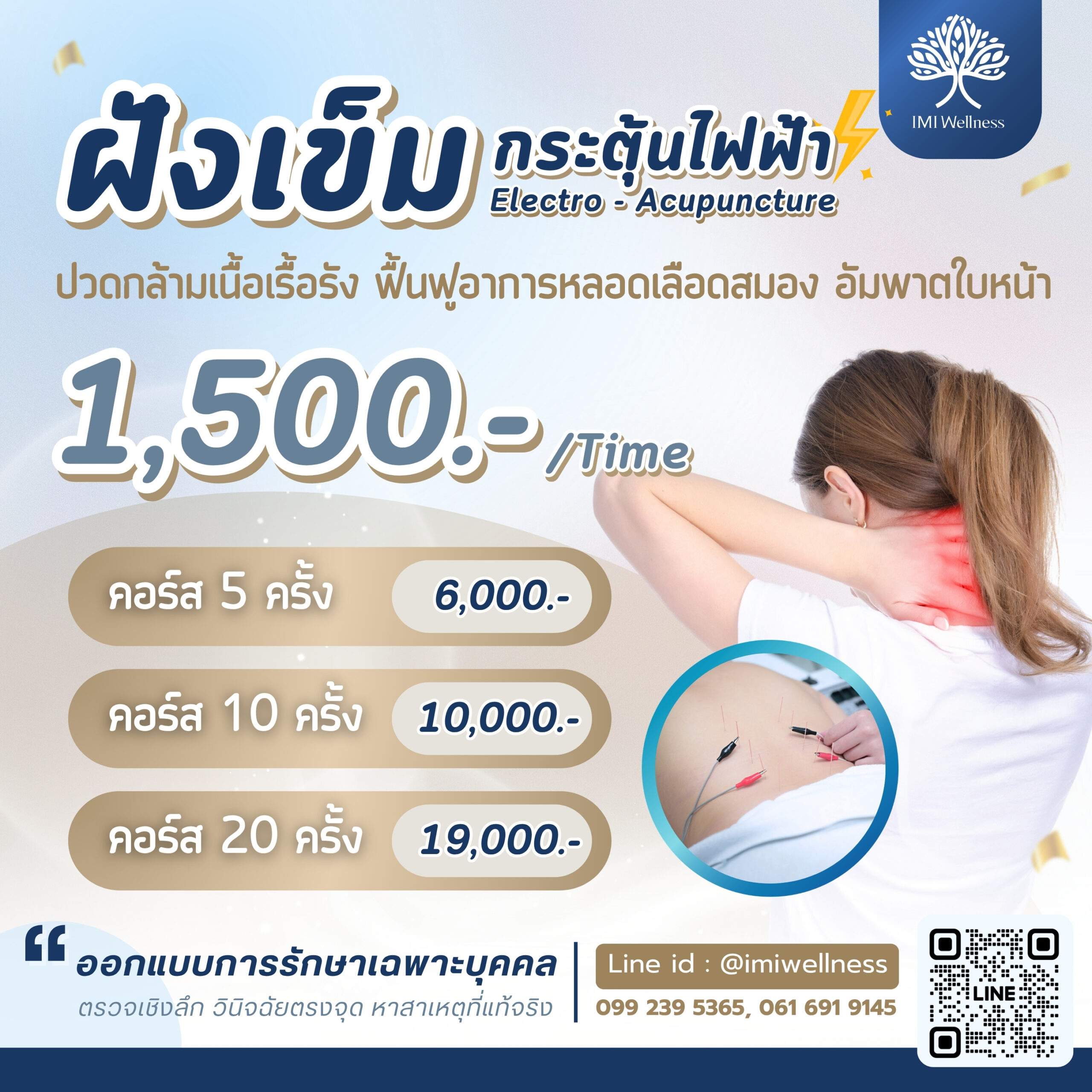 โปรโมชั่นฝังเข็มกระตุ้นไฟฟ้า Electro - Acupuncture