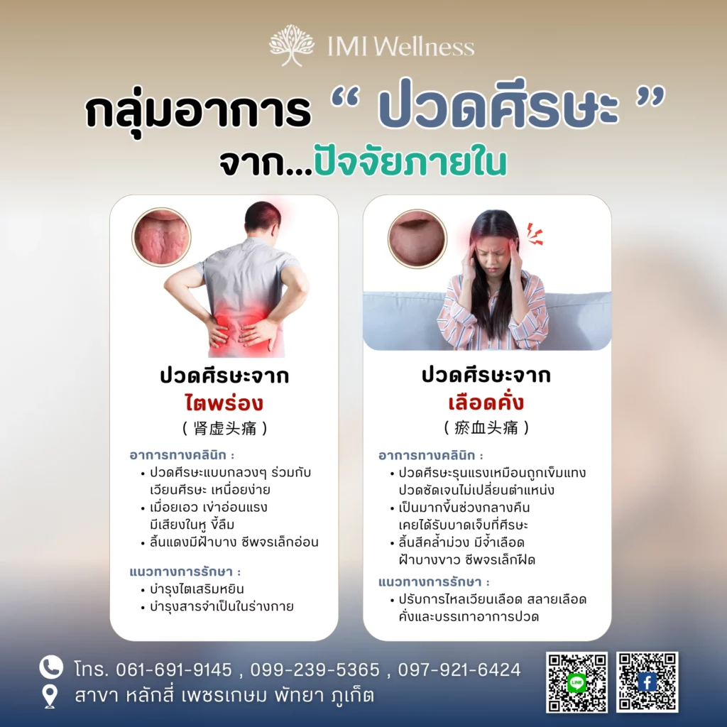 ฝังเข็มแก้ปวดหัว