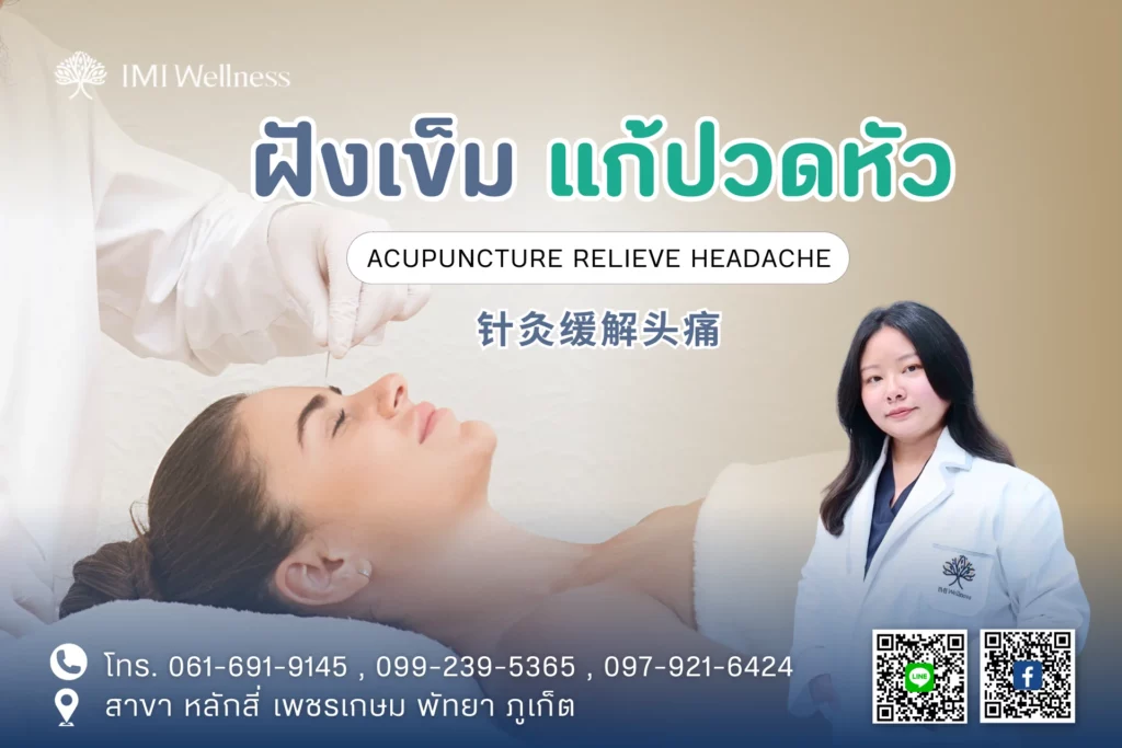 ฝังเข็มแก้ปวดหัว