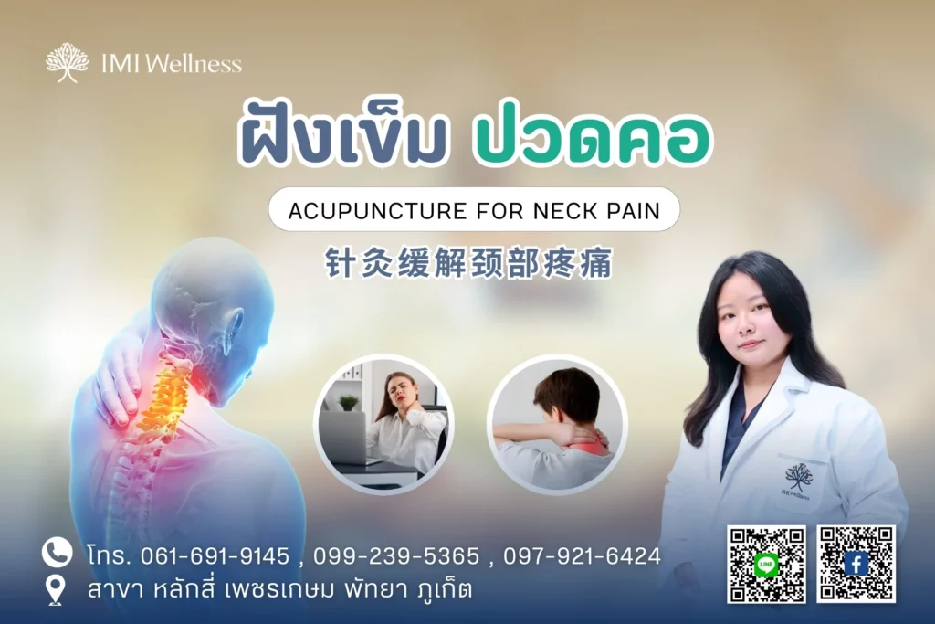 ฝังเข็มปวดคอ
