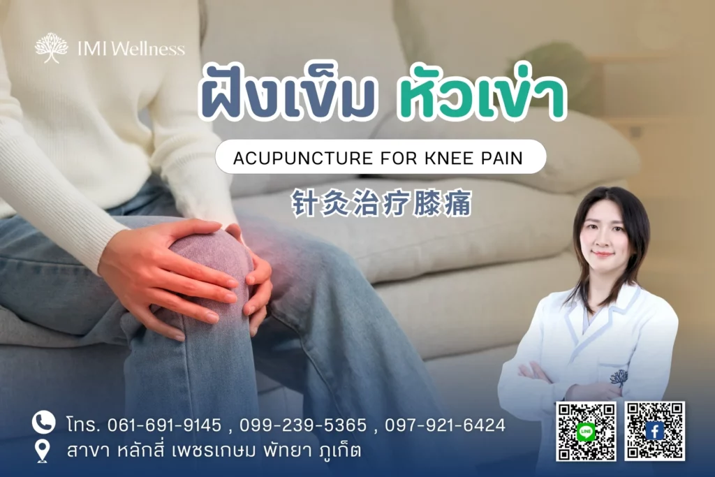 ฝังเข็มหัวเข่า