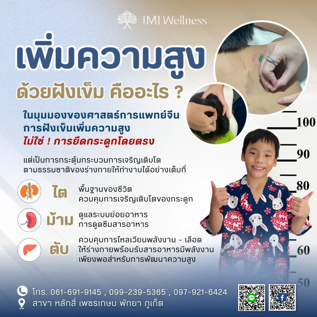 เพิ่มความสูงด้วยฝังเข็ม