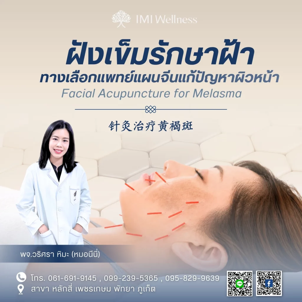 แพทย์จีนวริศรา หิมะ กับการฝังเข็มรักษาฝ้า