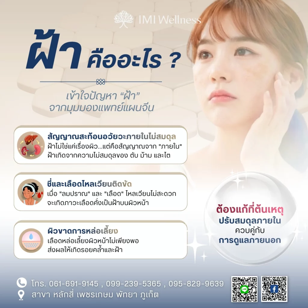 อินโฟกราฟิกสาเหตุของฝ้าตามมุมมองแพทย์แผนจีน