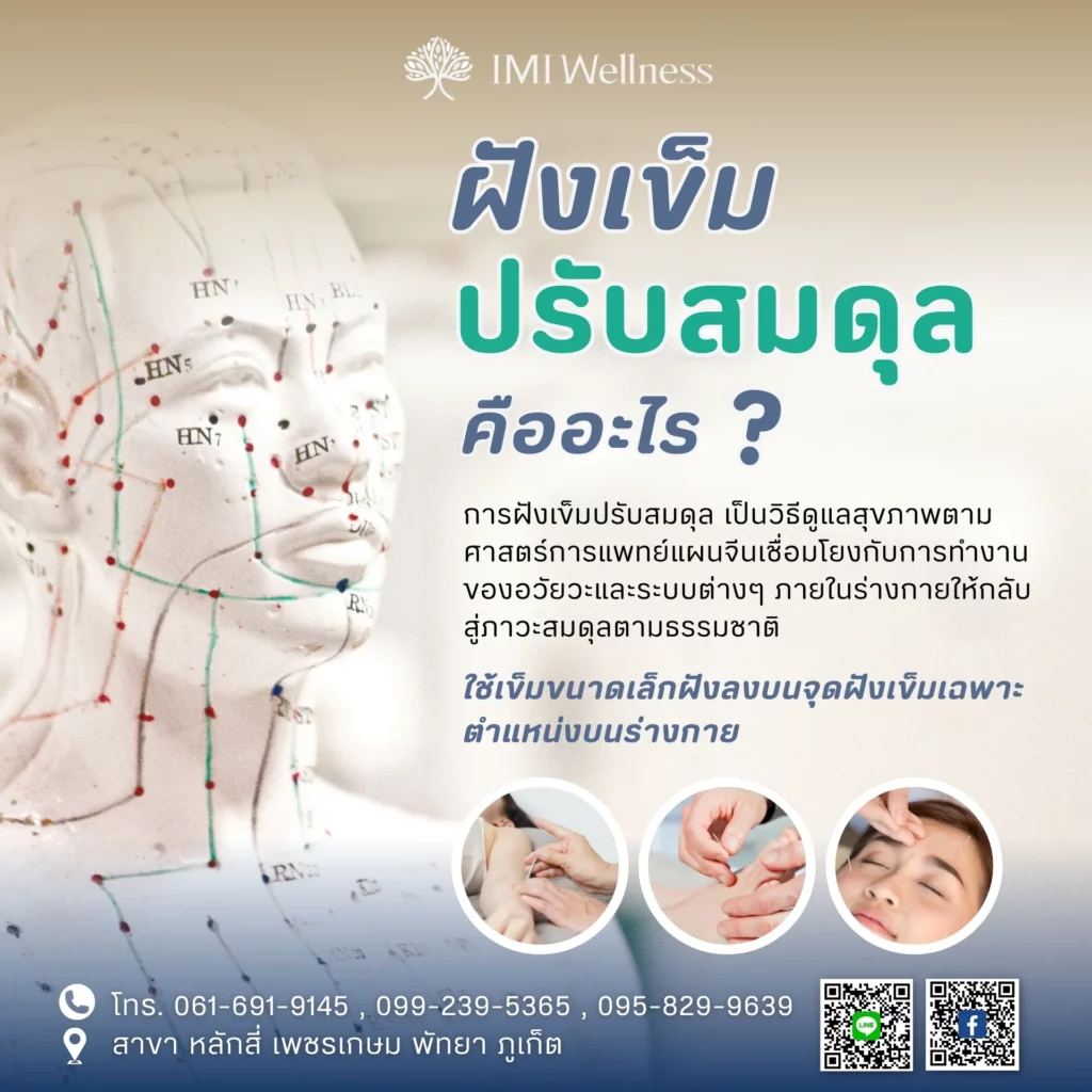 อินโฟกราฟิกอธิบายการฝังเข็มปรับสมดุลคืออะไร