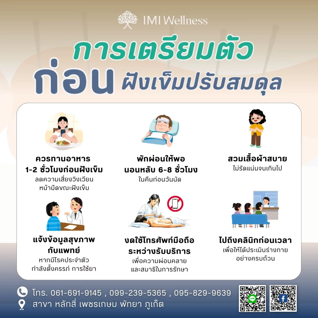 อินโฟกราฟิกการเตรียมตัวก่อนฝังเข็มปรับสมดุล