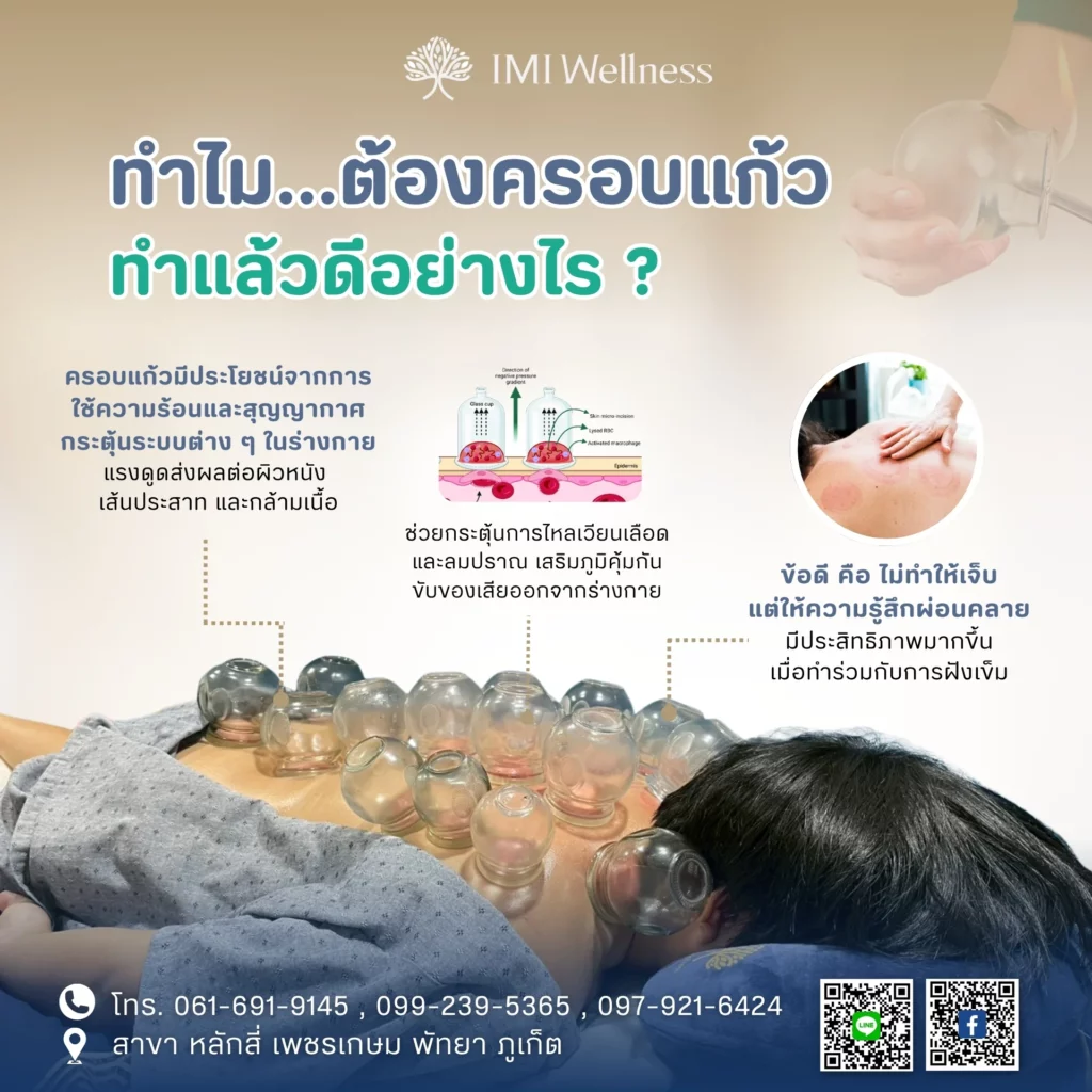 อินโฟกราฟิกเหตุผลและข้อดีของการครอบแก้ว