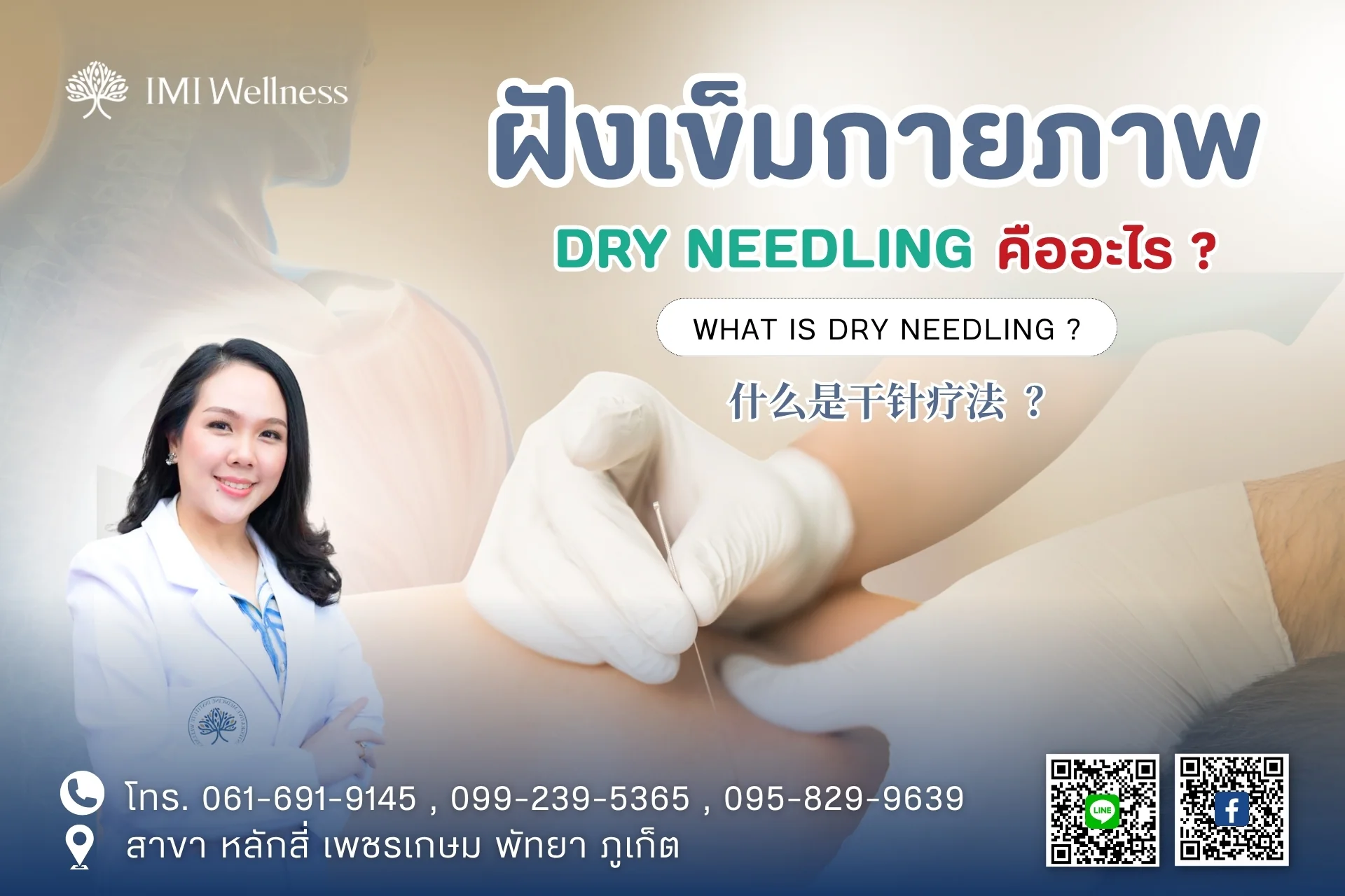 แพทย์จีนกำลังสาธิตฝังเข็มกายภาพ Dry Needling