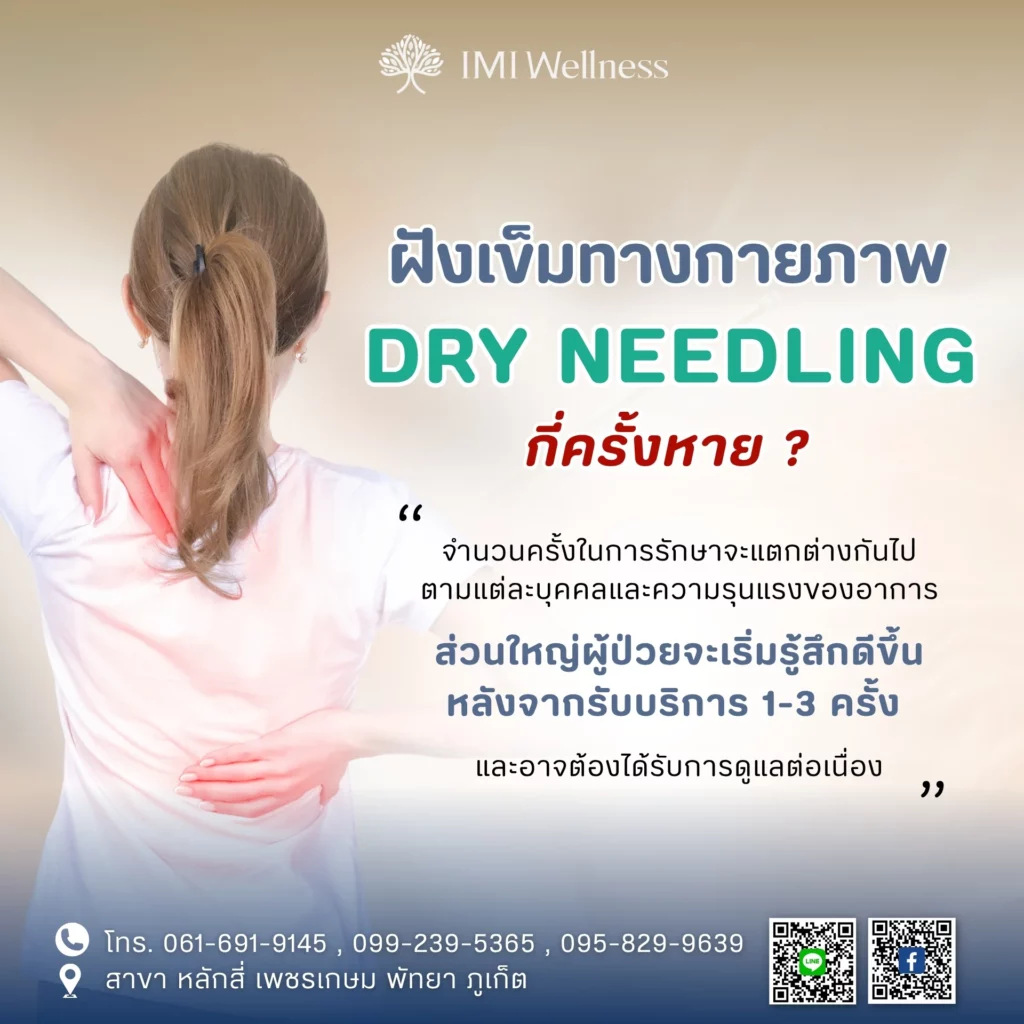 อินโฟกราฟิกจำนวนครั้งในการรักษาด้วย Dry Needling