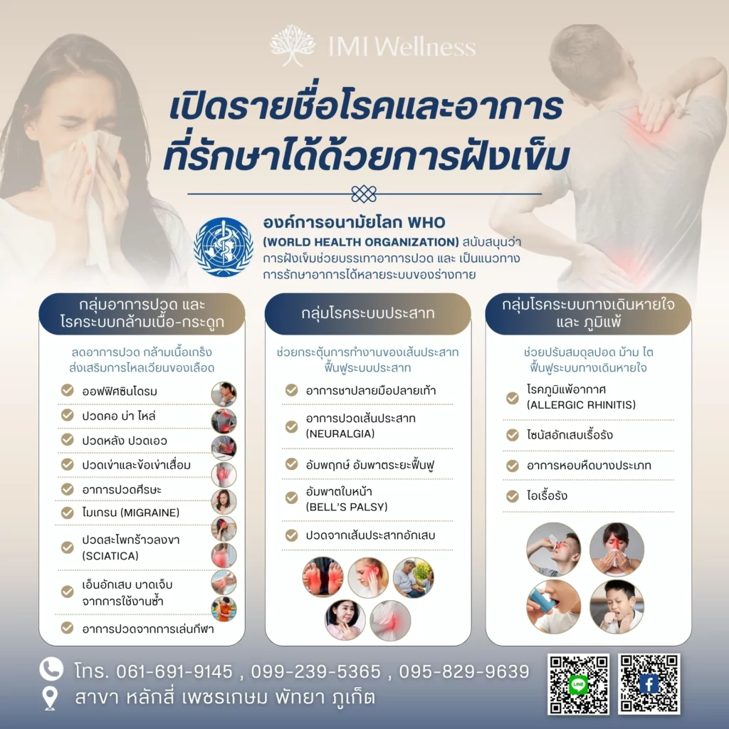 รายชื่อโรคและอาการที่รักษาได้ด้วยการฝังเข็ม ส่วนที่ 1