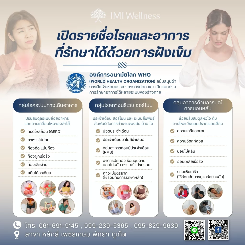 รายชื่อโรคและอาการที่รักษาได้ด้วยการฝังเข็ม ส่วนที่ 2