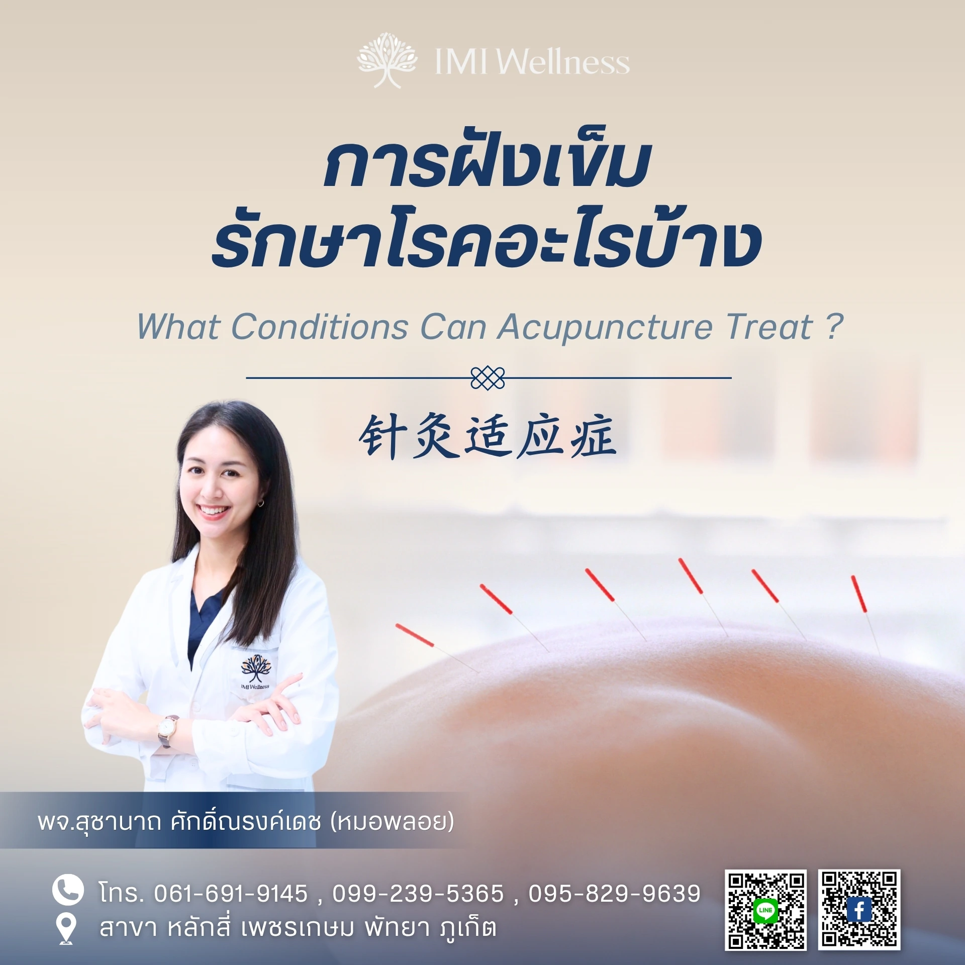 การฝังเข็มรักษาโรคอะไรบ้าง