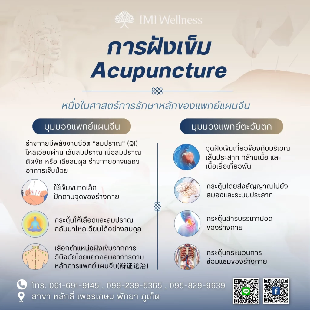 หลักการทำงานของการฝังเข็ม