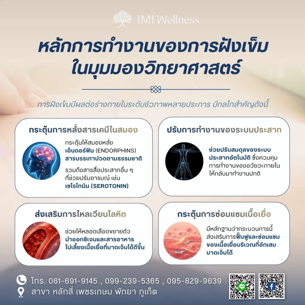 หลักการทำงานของการฝังเข็มในมุมมองวิทยาศาสตร์