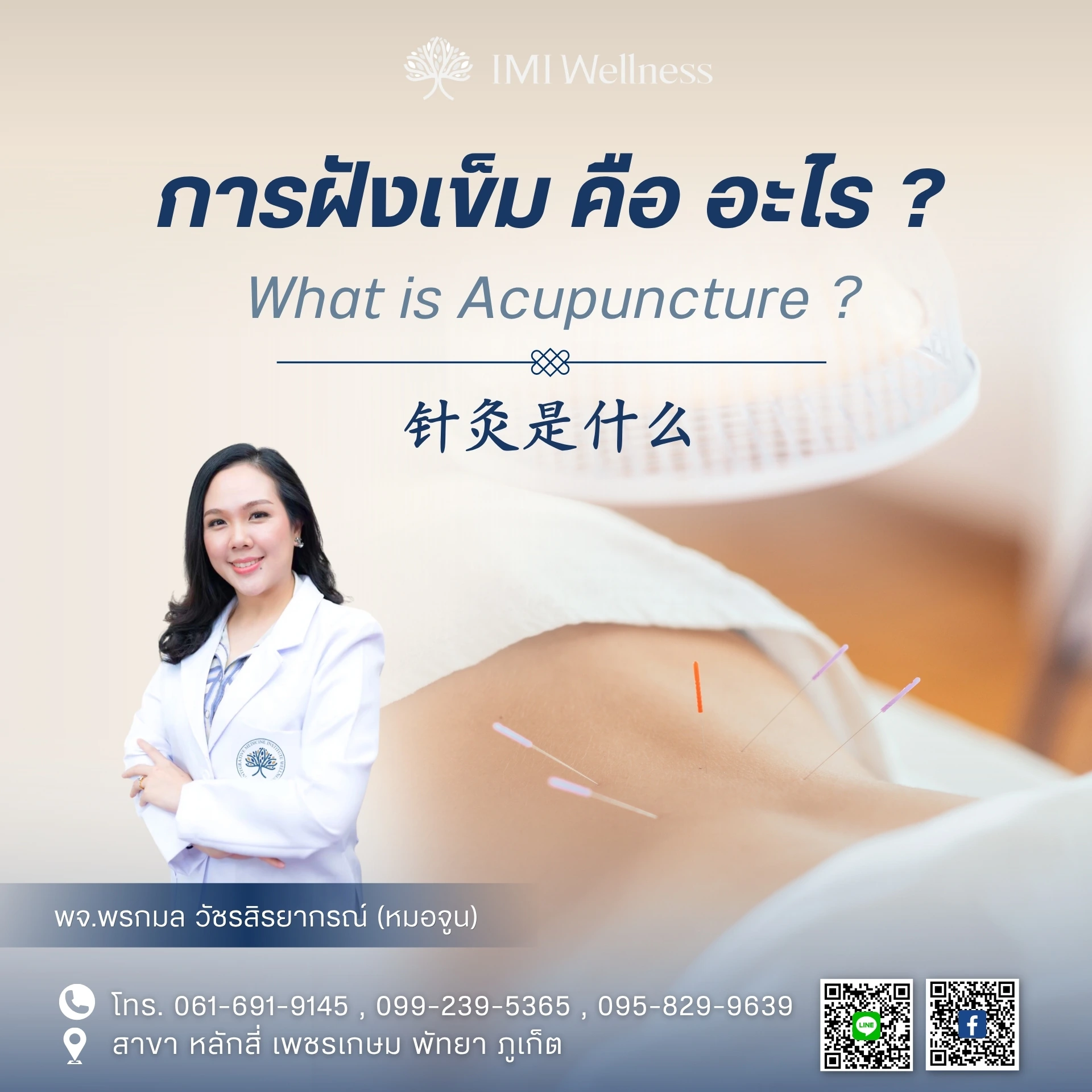 การฝังเข็มคืออะไร