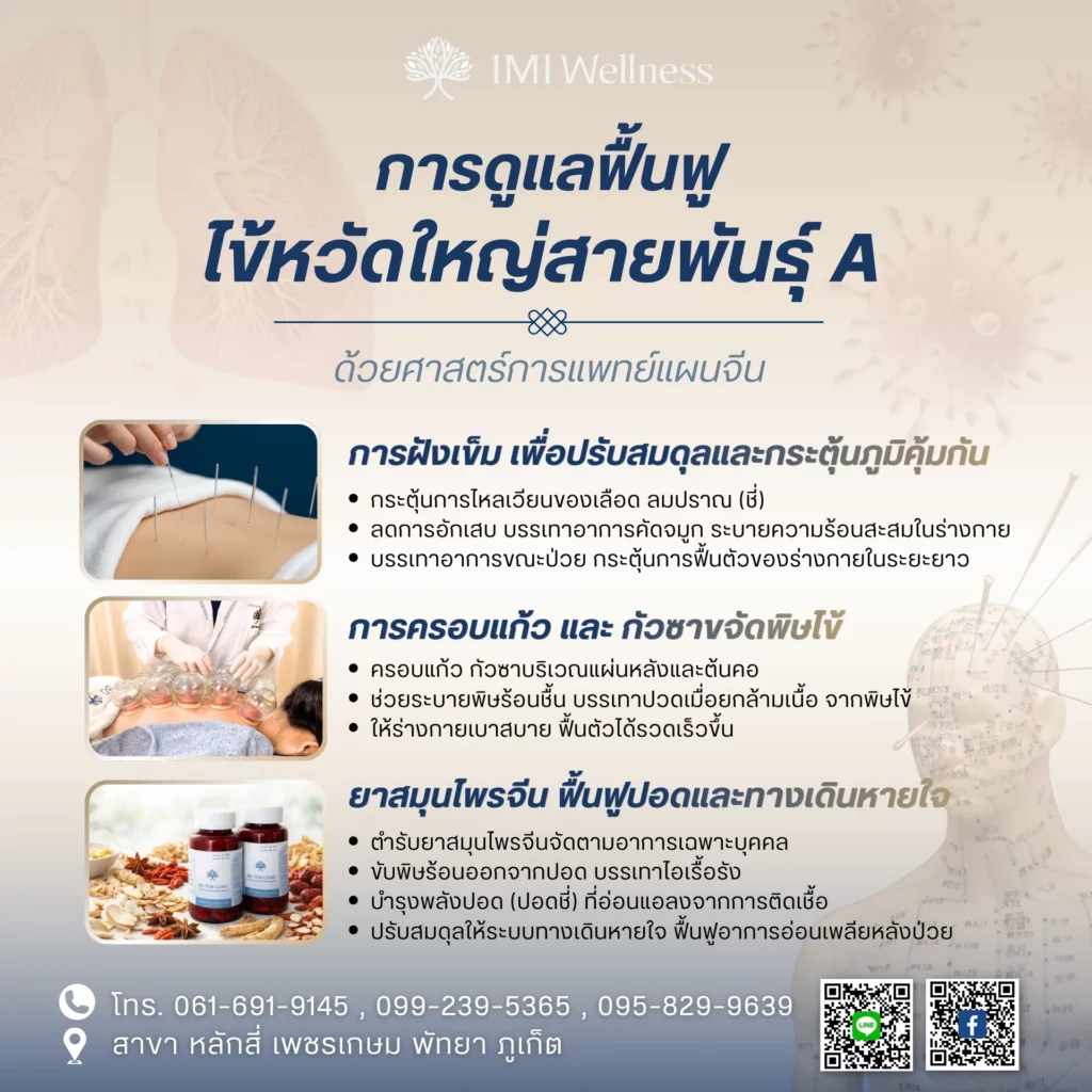 อินโฟกราฟิกการฟื้นฟูไข้หวัดใหญ่สายพันธุ์ A ด้วยฝังเข็ม ครอบแก้ว กัวซา และสมุนไพรจีน
