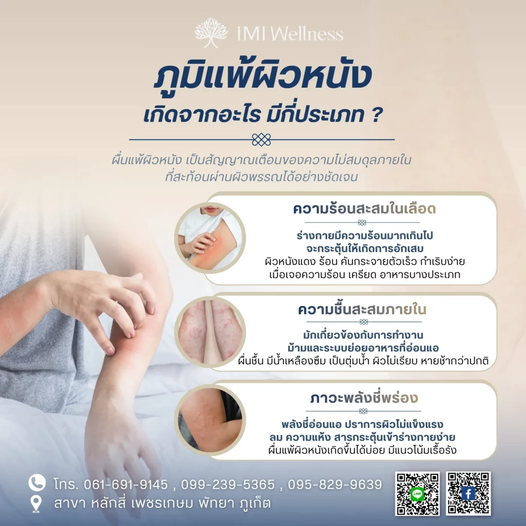 อินโฟกราฟิกสาเหตุและประเภทของภูมิแพ้ผิวหนังตามแพทย์แผนจีน