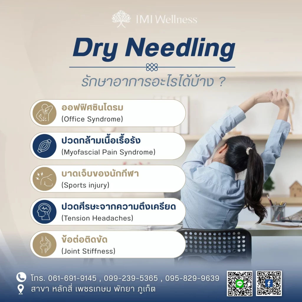 อินโฟกราฟิกอาการที่รักษาด้วย Dry Needling