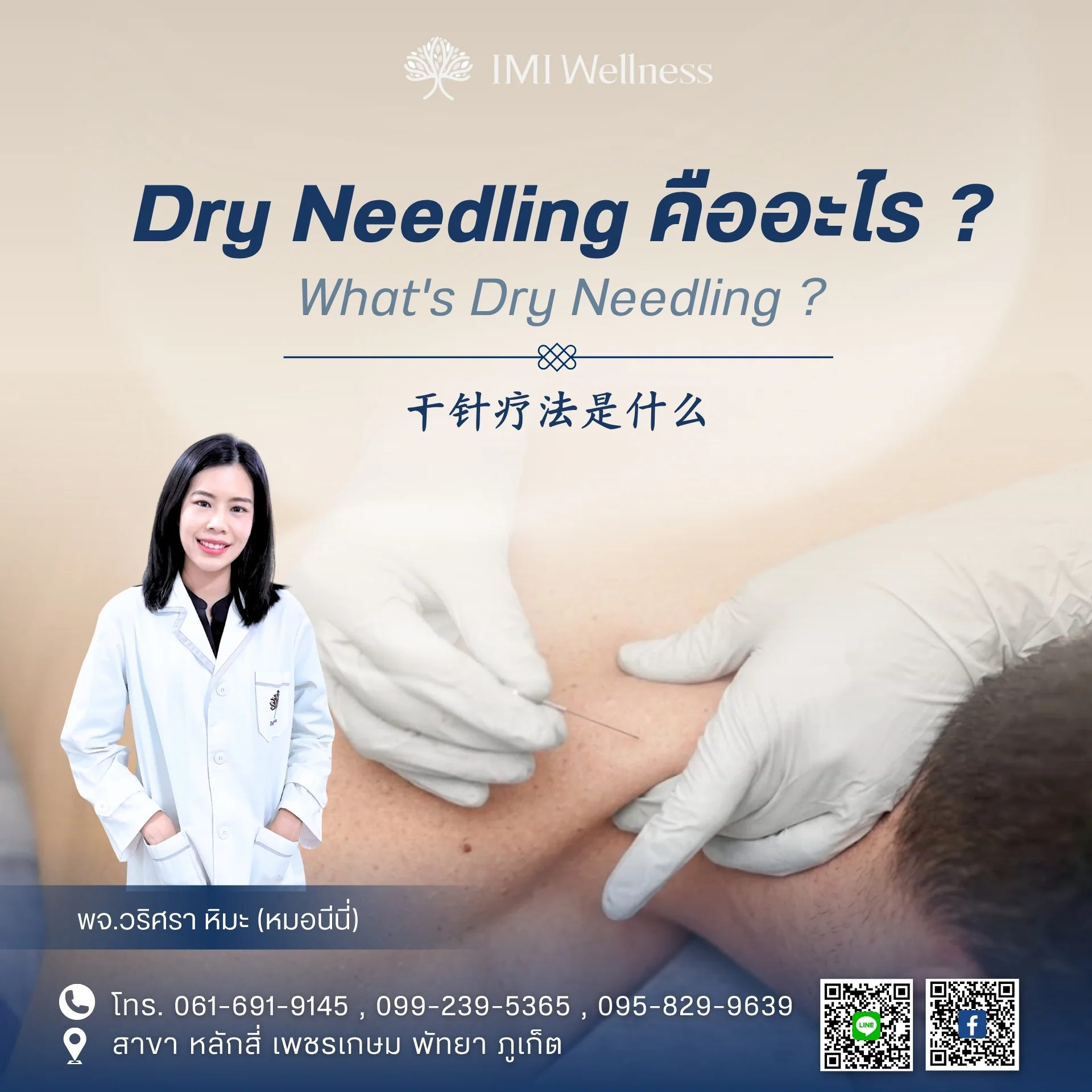 แพทย์จีนวริศรา หิมะ สาธิตการทำ Dry Needling