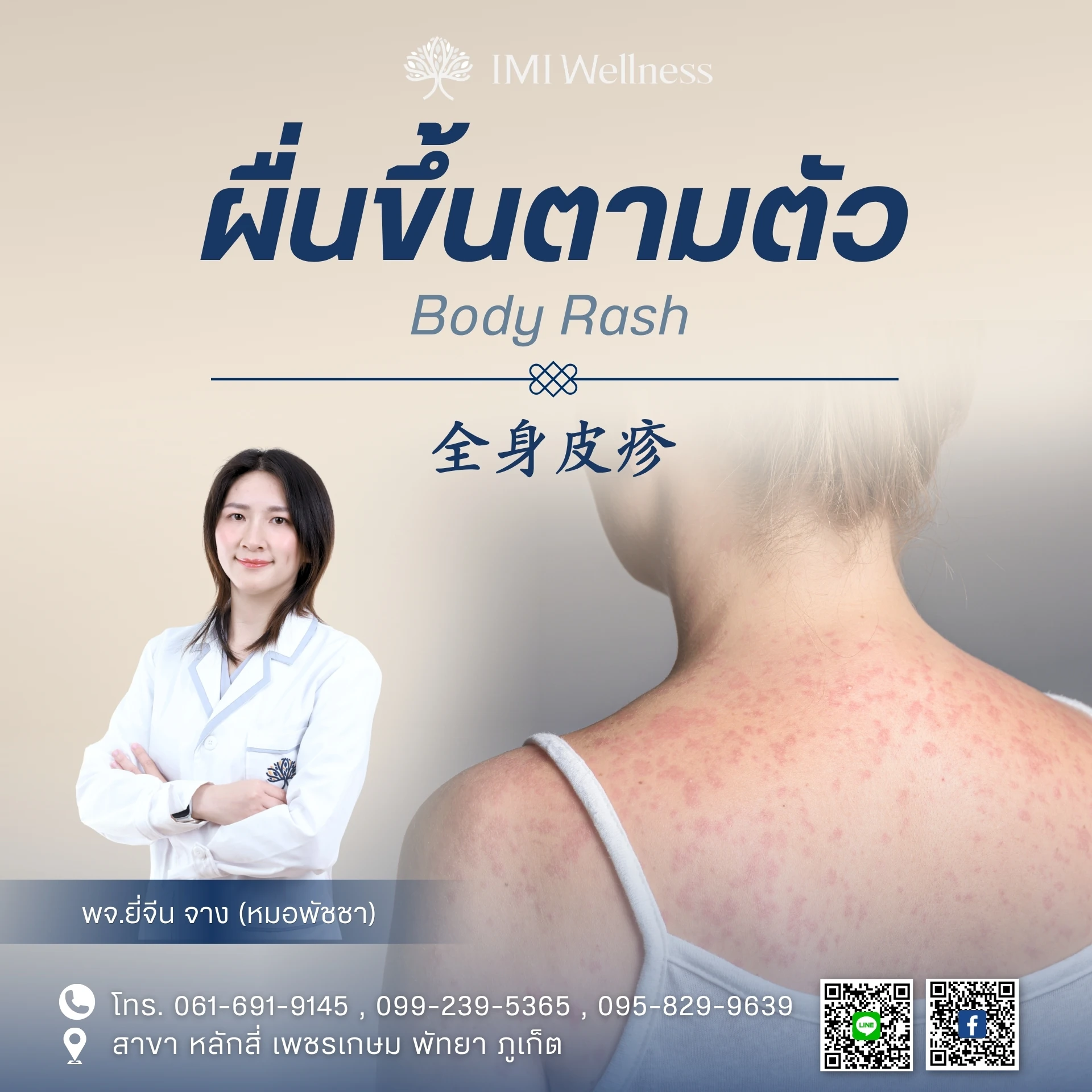 ผื่นขึ้นตามตัว