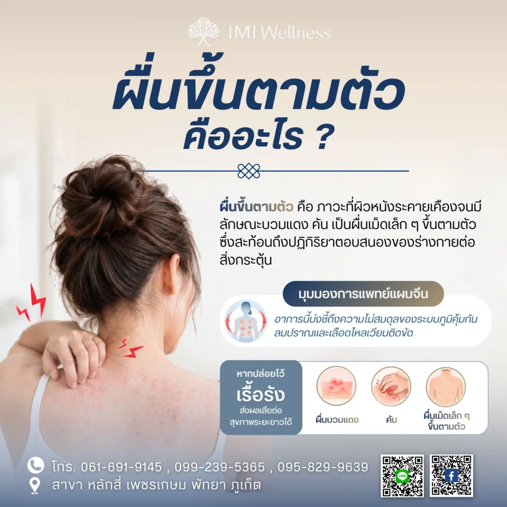 ผื่นขึ้นตามตัว คืออะไร?