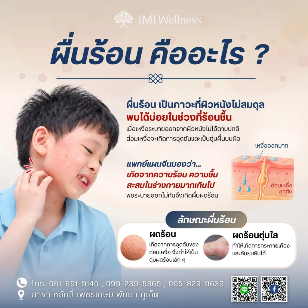 ผื่นร้อน คืออะไร?