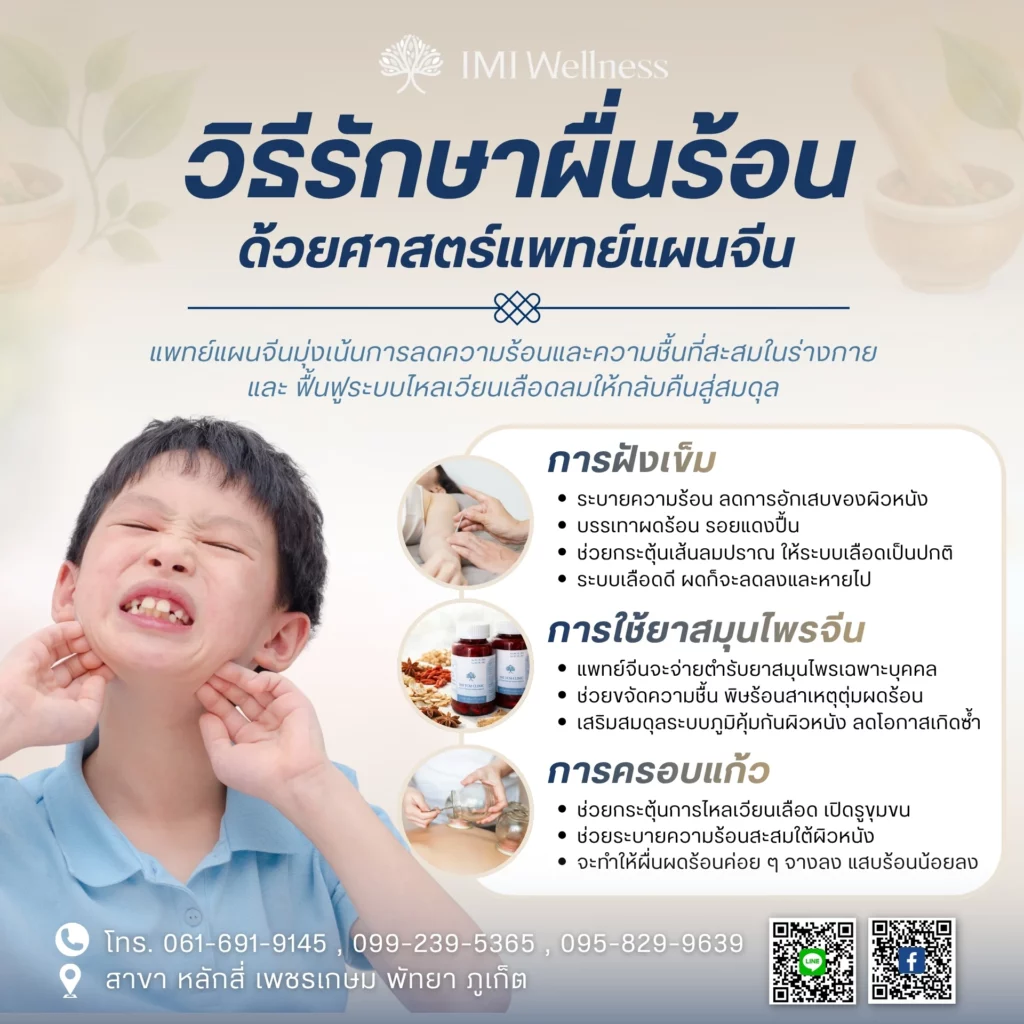 วิธีรักษา ผื่นร้อน ด้วยแพทย์แผนจีน