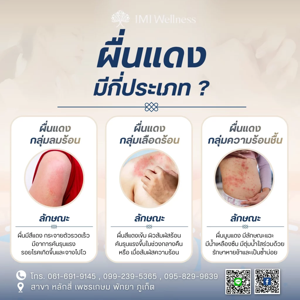 ผื่นแดง มีกี่ประเภท?