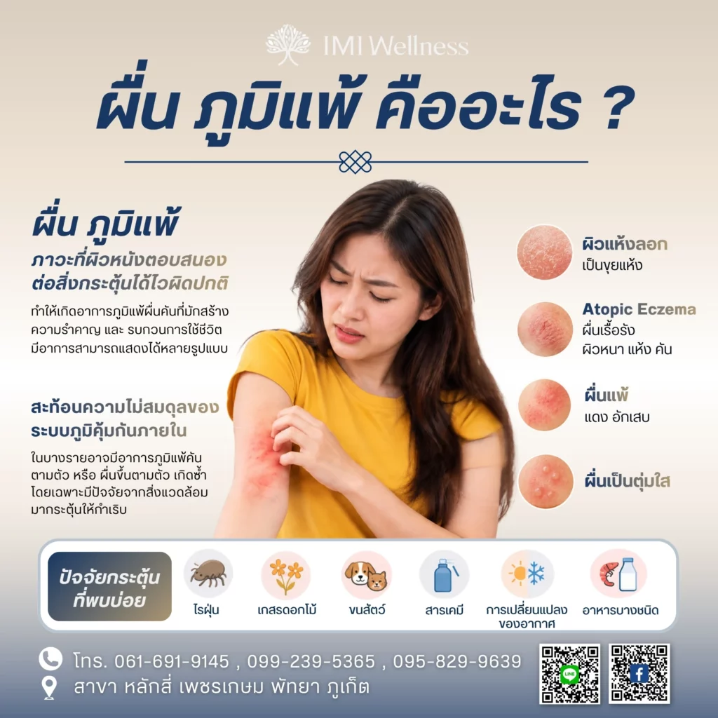 ผื่น ภูมิแพ้ คืออะไร?
