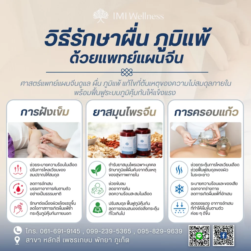 วิธีรักษา ผื่น ภูมิแพ้ ด้วยแพทย์แผนจีน