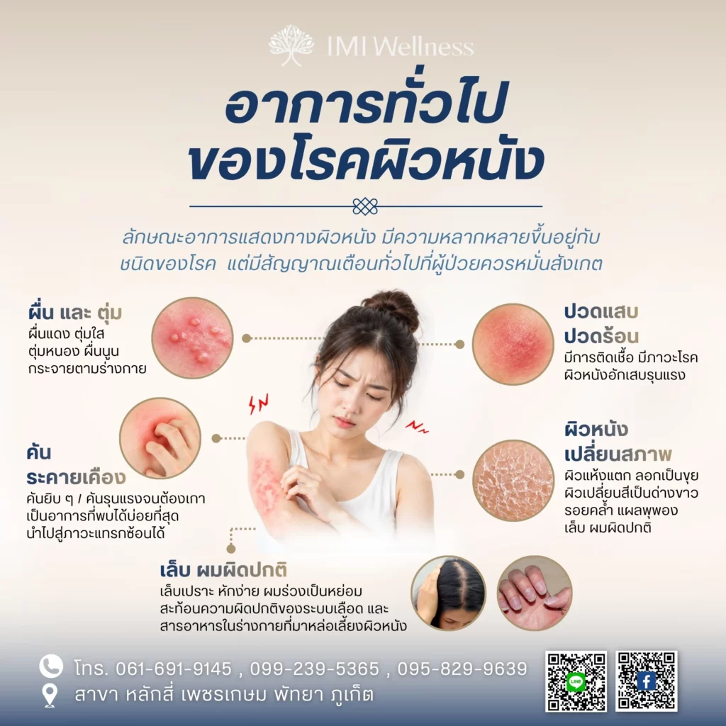 อาการทั่วไปของโรคผิวหนัง