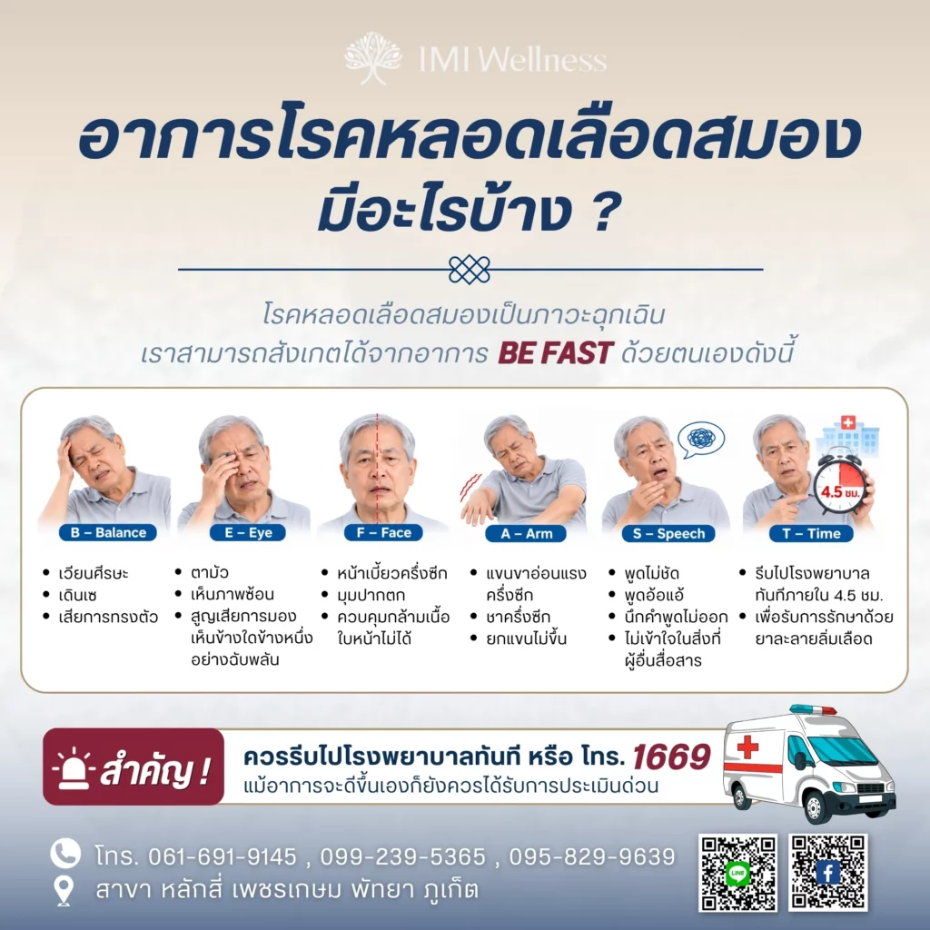 สัญญาณเตือนโรคหลอดเลือดสมอง BE FAST และการรับมือฉุกเฉิน