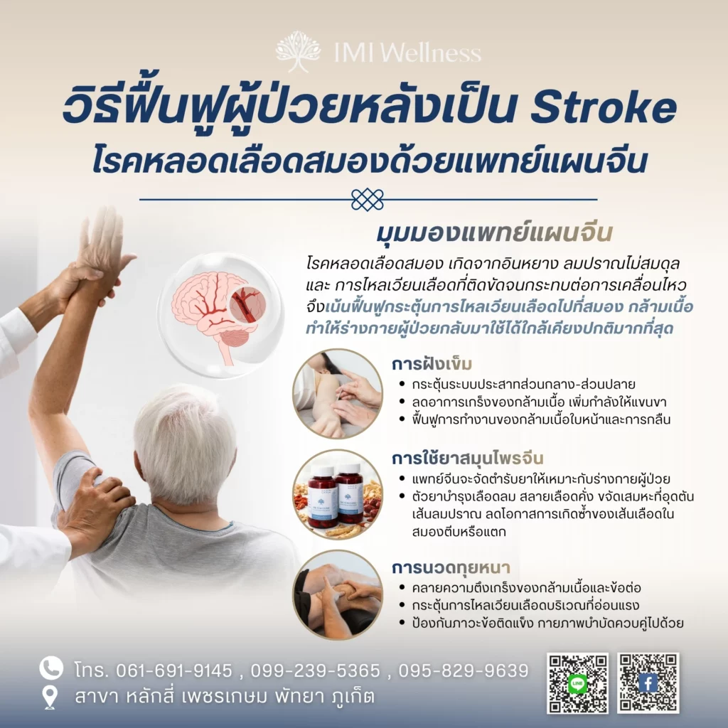 วิธีฟื้นฟูผู้ป่วยหลังโรคหลอดเลือดสมองด้วยแพทย์แผนจีน
