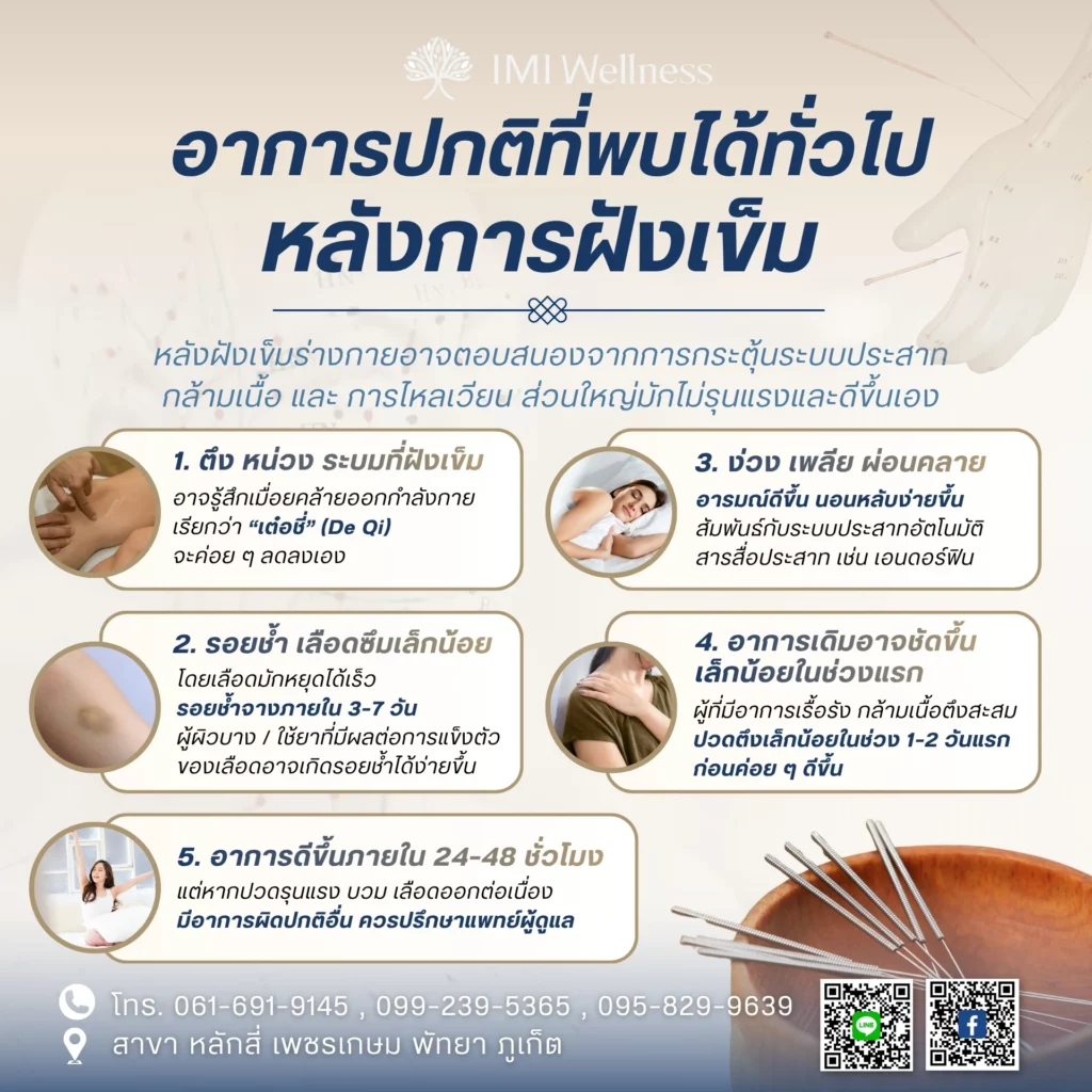 อาการปกติที่พบได้ทั่วไปหลังการฝังเข็ม