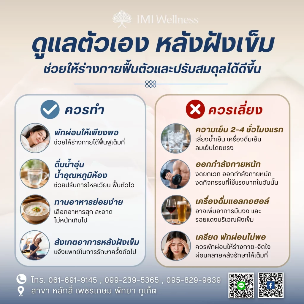 วิธีดูแลตัวเองหลังฝังเข็มและสิ่งที่ควรเลี่ยง