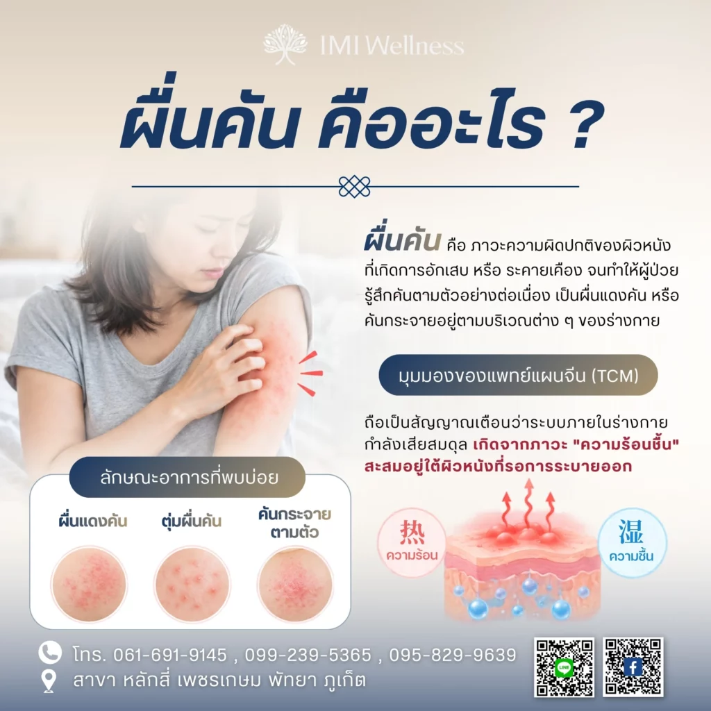 ผื่นคัน คืออะไร?