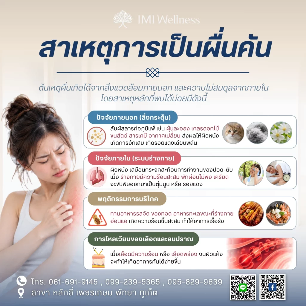 สาเหตุของการเป็นผื่นคัน
