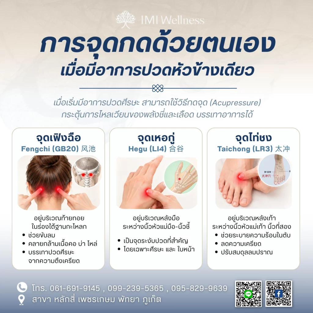 การจุดกดด้วยตนเองเมื่อมีอาการปวดหัวข้างเดียว